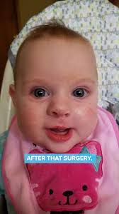 You would never know it today, but Paige's head was severely misshapen at  the start of her life. Born in 2014 with sagittal craniosynostosis, Paige  had a long, skinny head because the