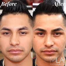 Tattoo microblading men's eyebrows see before and after microblading isn't just for ladies! Spaatspringridge Medspa Wyomissing Microblading Eyebrows Call For More Info 610 880 8265 And Click Th Guys Eyebrows Eyebrow Shaping Microblading Eyebrows