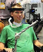 List Of People With Amyotrophic Lateral Sclerosis Wikipedia
