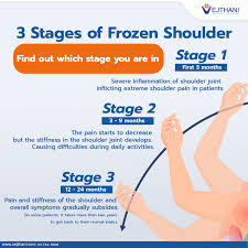 Image result for Frozen Shoulder