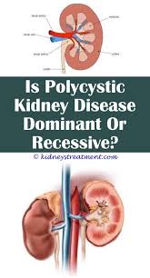 Epingle Sur Kidney Disease Cancer