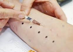 In the long run, the cost of injections may be less than taking a daily. Allergy Shots