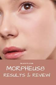 Your best attempts to soothe and conceal the swelling haven't given you the results you want. Morpheus8 Review Are The Results Really Equivalent To A Facelift