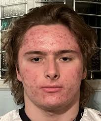 South High back Angelo LaRose enjoys unforgettable experience in Italy