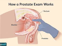 Furthermore, manual prostate massage is discouraged for men with acute bacterial prostatitis as it if performing prostate massage for sexual purposes, it often helps to achieve a state of arousal first. Prostata Squat Does Prostate Massage Reduce Cancer Risk