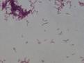 Image result for mycobacterium phlei schizophrenia