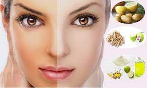 Go Out In The Sun Without The Fear Of Getting Tanned, 10 Home Remedies For  Removing