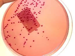 Gram Stain Definition And Patient Education