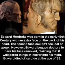 Edward Mordrake Caso