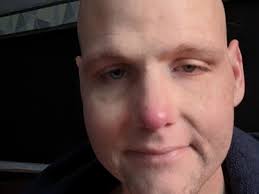 Fundraiser by Zach Merrill : My trip to a cure