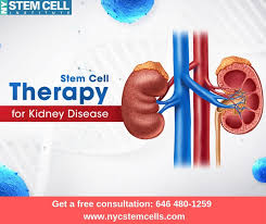 In The United States The Two Leading Causes Of Kidney Failure Also Called End Stage Kidney Disease Are Diabetes And High Blood Pr Stem Cell Therapy Treatment For Kidney Disease Kidney