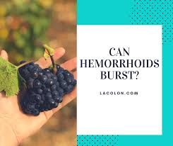 Thrombosis can occur in internal and external hemorrhoids. Burst Hemorrhoid Symptoms