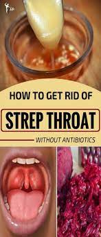 How To Get Rid Of Strep Throat Without Antibiotics Global Medicine Strep Throat Strep Throat Cure Strep Throat Remedies