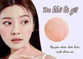 Da Khô: Nguyên Nhân, Biểu Hiện, Cách Điều Trị Khô Da | TIKI