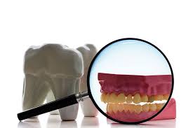 We did not find results for: Root Canal Therapy In Madison Nj Root Canal Therapy In 07940