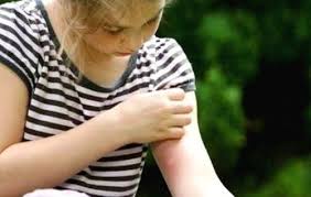 Repellente Per Le Zanzare Fatto In Casa Biologico Eticamente Net Rimedi Rimedi Contro Le Zanzare Rimedi Naturali