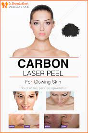A Carbonlaserpeel Is A Revolutionary Lasertreatment That Is Completely Painless With Minimal To Zero Downti Skin Treatments Skin Care Treatments Laser Clinic