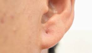 What Does It Take For You To Be Happy In Your Relationship If You Are Trying To Improve Your Relationship Or Your Marriage Skin Tissue Ear Piercings Treatment