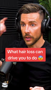 The Impact of Hair Loss