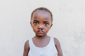 William hadde grå stær