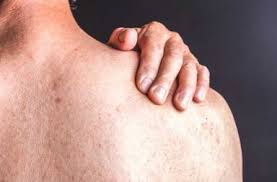 الصدفية أنواعها تشخيصها وعلاجها أنا أصدق العلم