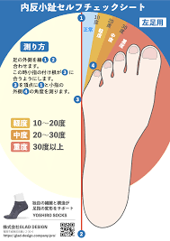 内反小趾セルフチェックシートで足指の変形を確認しましょう！ | 足指研究所｜YOSHIRO STUDIO