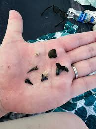 What could cause a sting in the water at Holden Beach?