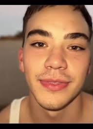 Like The Scar of Age Baseball