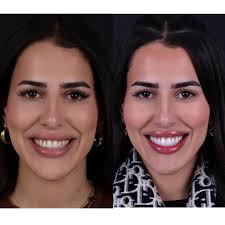 INTEGRA DENTAL CARE (@drhatemsadek) · Instagram 照片和视频