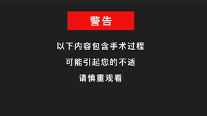 Go to www bing comhella www bing comseattle/page/4. ç—…ä¾‹ç½' èƒ½æ‰¾åˆ°æ•°ç™¾ä¸‡æ‰‹æœ¯è§†é¢'æ¡ˆä¾‹çš„ç½'ç«™ æ™®åŠåŒ»ç–—çŸ¥è¯† æŽ¨è¿›åŒ»å­¦å'å±•