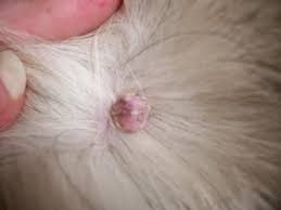How To Remove Embedded Ticks Embedded Tick Or Mole Laser Treatment Photography Natural Remedies