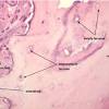 Diagram of blood and nerve supply to bone. 1