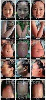 Many of them claimed that purtier has. Purtier Placenta