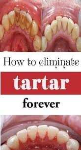 However, you could be worried about how coffee is going to affect your teeth. Brush Your Teeth With This Mixture And Say Goodbye To Tartar And Caries Forever Healthy Teeth Teeth Health Tartar