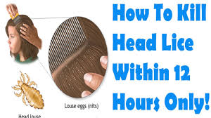 Rinse with warm water and vinegar. Howto How To Get Rid Of Lice Eggs Without Comb