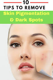 13 Home Remedies To Remove Pigmentation Naturally At Home Trabeaulli Pigmentation Remedy Spots On Face Dark Spots On Face