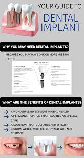 If You Are Looking For A Permanent Option For Tooth Replacement Dental Implants Is The Option For Dental Implants Tooth Replacement Dental