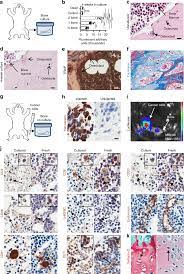 There is no other evidence of myeloma anywhere else in the body. Bone Marrow And Cancer Cells Survive In Ex Vivo Co Cultures A Download Scientific Diagram