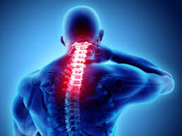 What is the best treatment for cervical radiculopathy. Cervical Radiculopathy Rockville Md Mri Radiology Clinic
