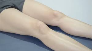 Image result for Patellar Apprehension Test