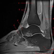 Other imaging techniques commonly provide information complementary to mri. Mri Of The Ankle Detailed Anatomy W Radiology
