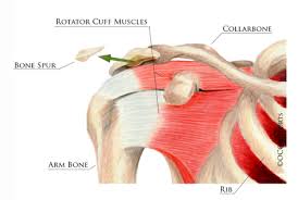 Image result for Rotator Cuff Rupture