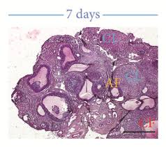 Image result for Phyllanthus muellerianus