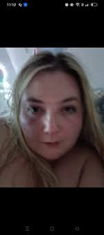 Who else played this in detox or treatment?