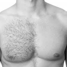 Where can i buy the revitol hair removal cream? Revitol Hair Removal Cream Home Facebook