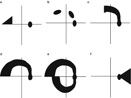 Image result for Visual Field Deficit