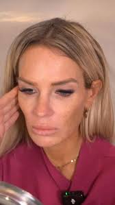 Brows lifted ✔️ Under-eyes & temples supported ✔️ Smile lines softened ✔️  Skin quality improved ✔️ This is what a comprehensive facial rejuvenation  plan looks like ✨ Stay tuned to see our