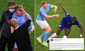 Chelsea wint de champions league. Kevin De Bruyne Leaves Hospital With Fractured Nose And Left Orbital Eye Injury Daily Mail Online