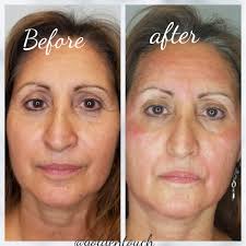 Bareface Ink Golden Touch