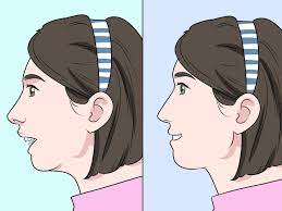 An overbite alters the relationship between upper and lower jaws. How To Fix Overbite Without Surgery Cardsdental